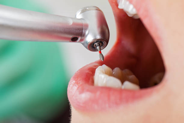 Best Weekend Emergency Dentist in Grundy, VA